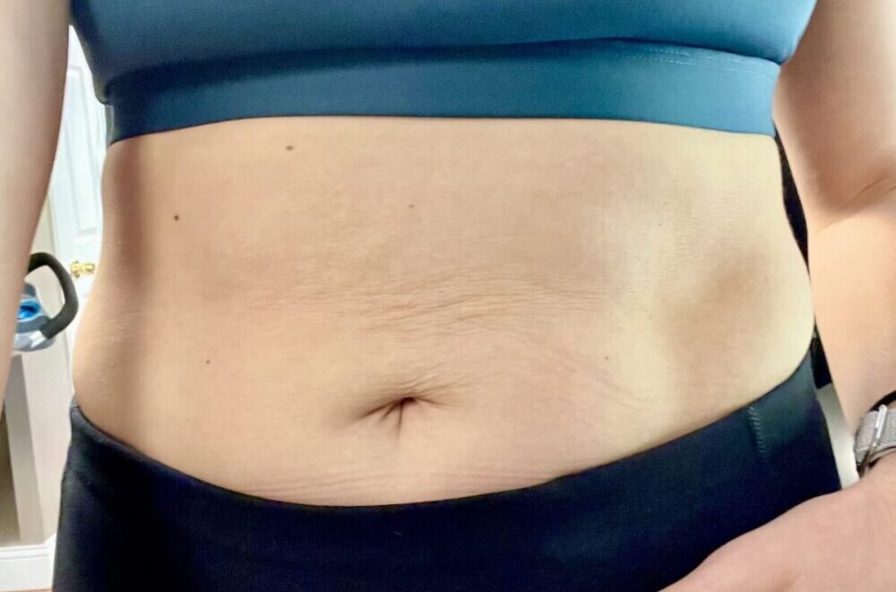 A women's imperfect stomach demonstrating body acceptance.